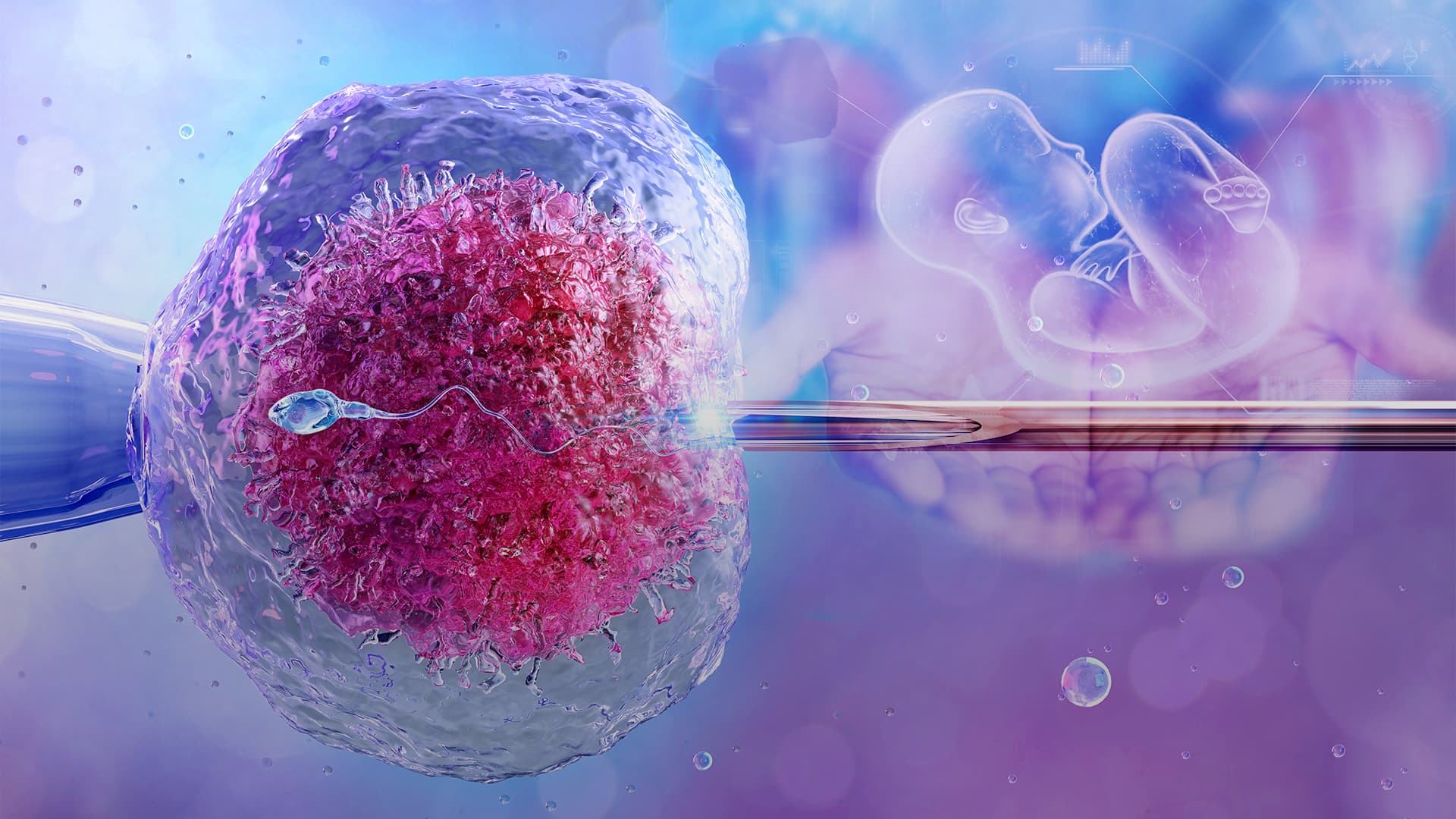 Adım Adım Tüp Bebek (IVF) Tedavisi Süreci
